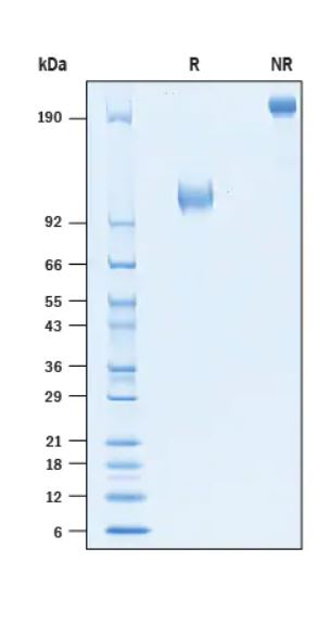 2 μg/lane Protein  was resolved with SDS-PAGE under reducing (R) and non-reducing (NR) conditions and visualized by Coomassie® Blue staining.
